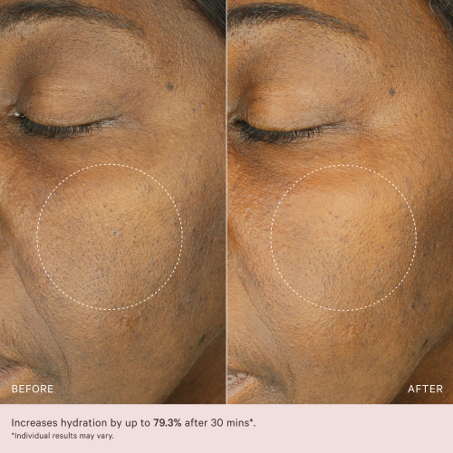 Hydra-Boost Ampoules